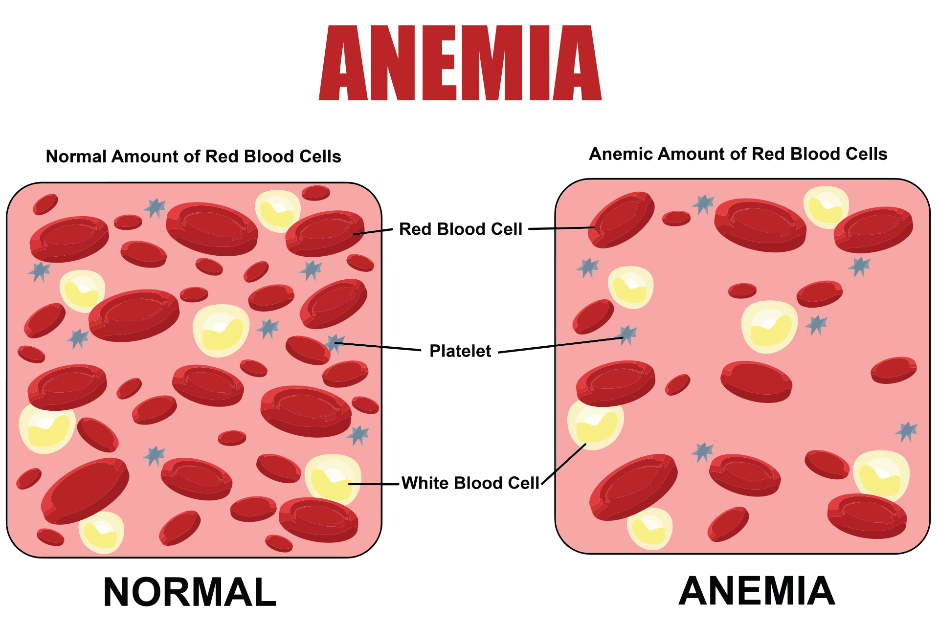 La anemia descontrola la menstruación