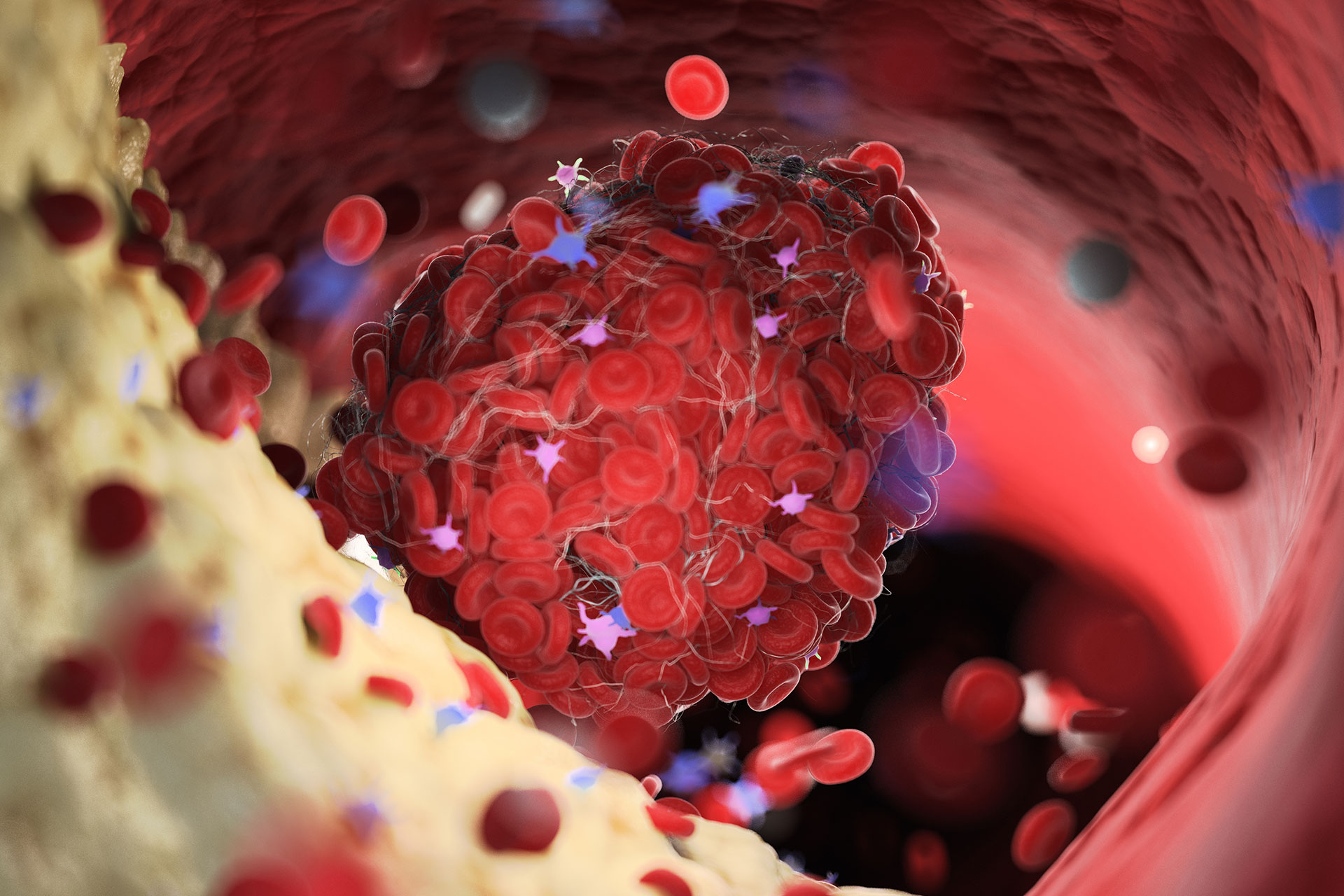 graphic of blood clotting