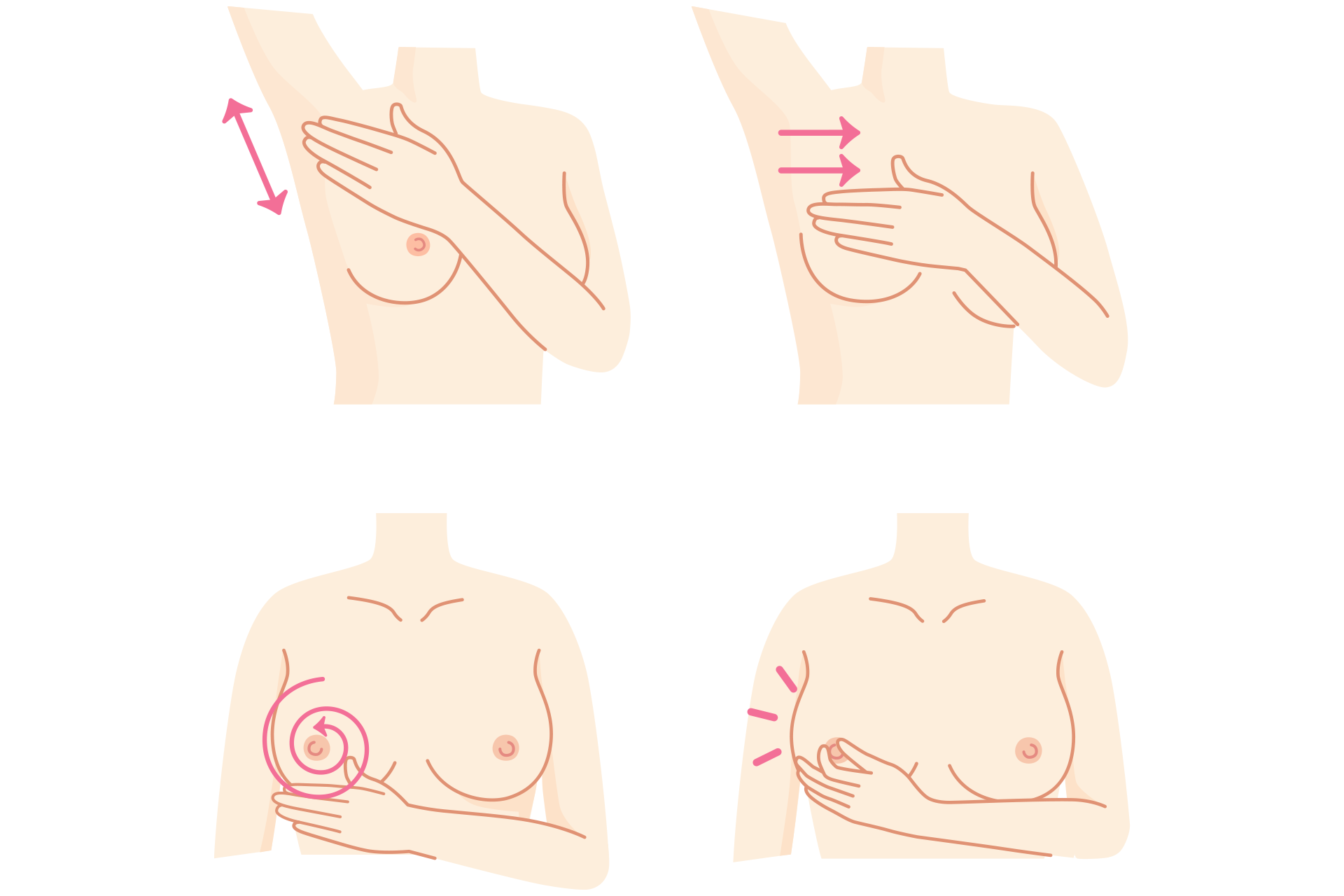Breast cancer examination