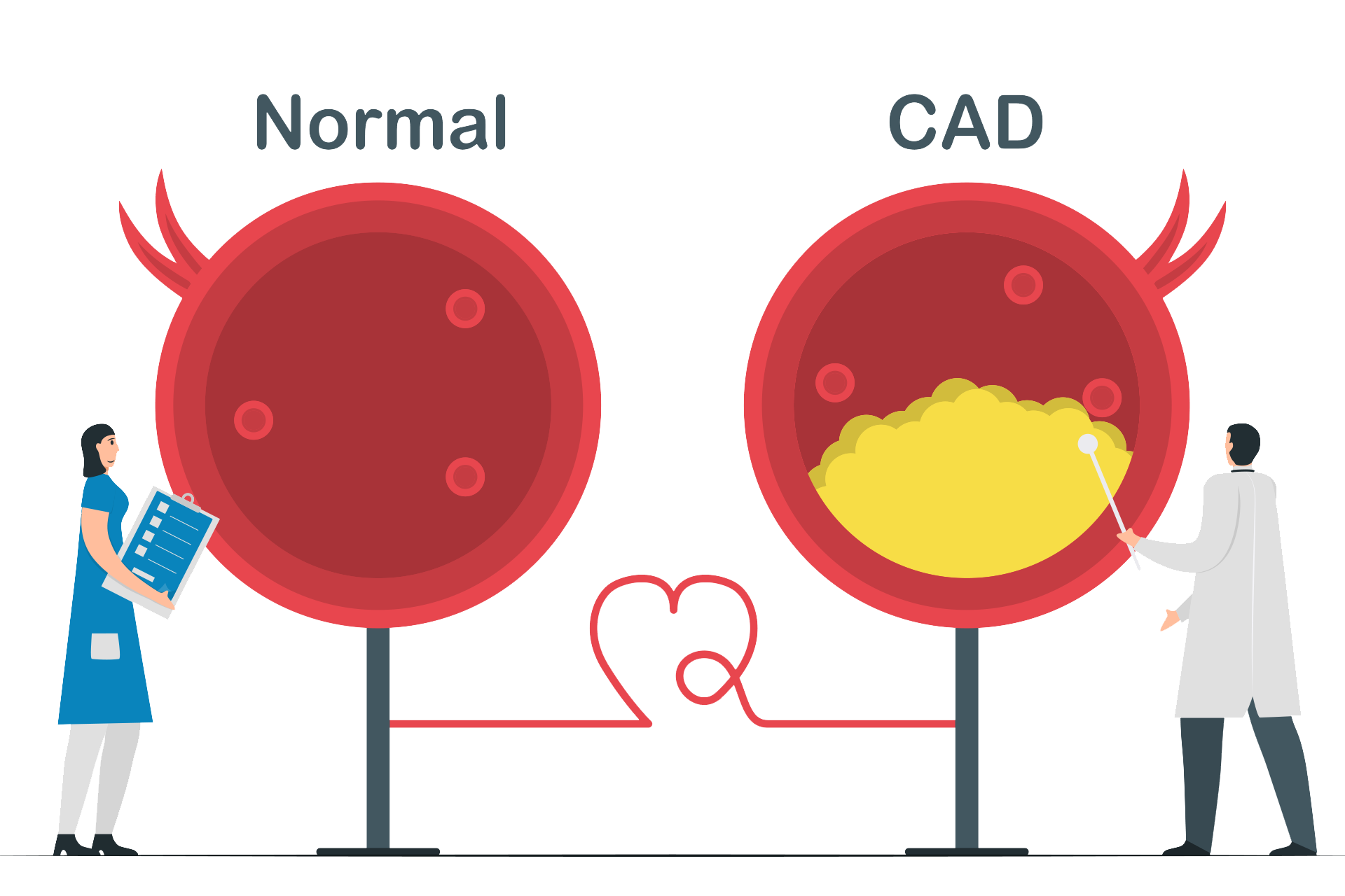 CAD disease