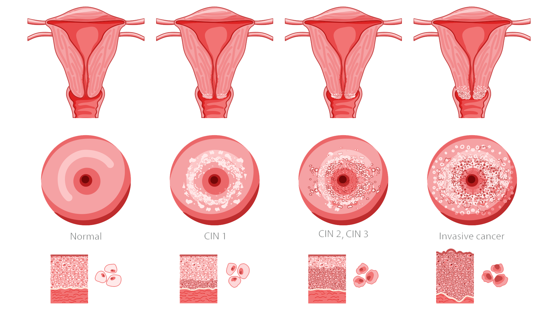 Hero-Cervix-Cancer-Graphic cervical health awareness month