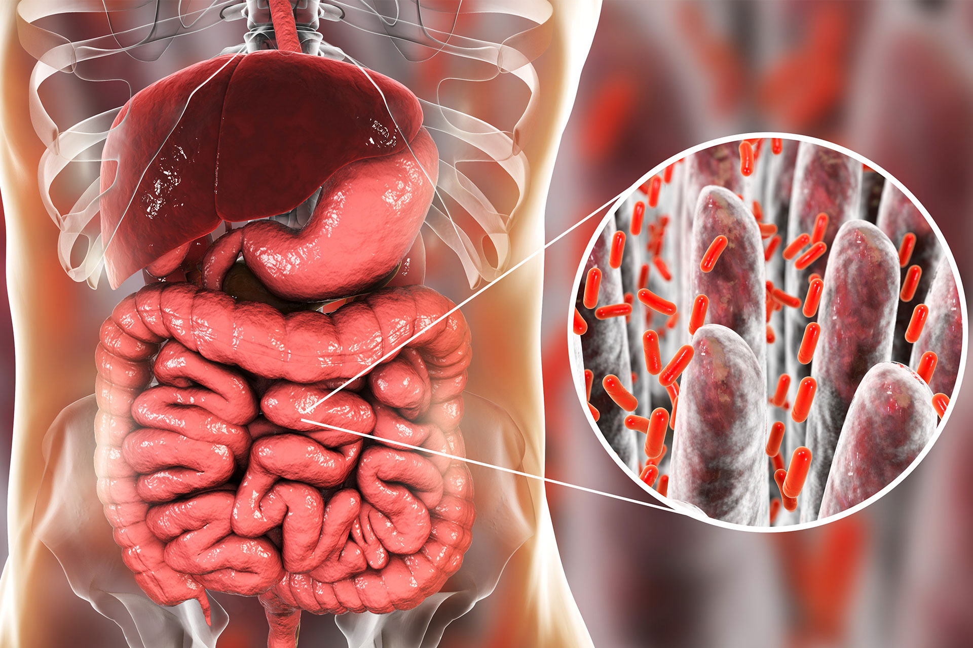 Digestive tract paralysis graphic