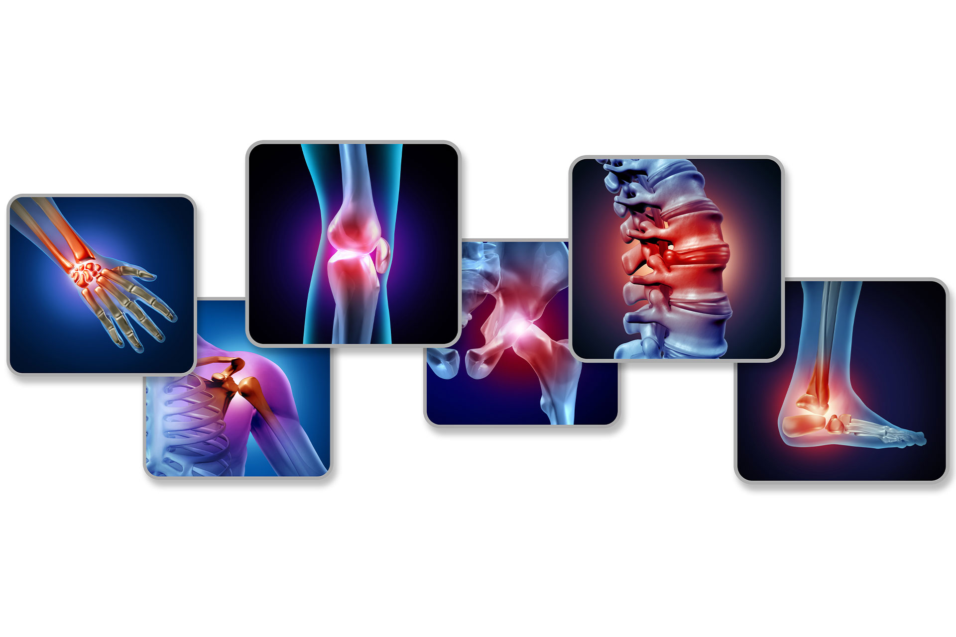 Hero-Fibromyalgia-X-Ray graphic showing how fibromyalgia affects the body
