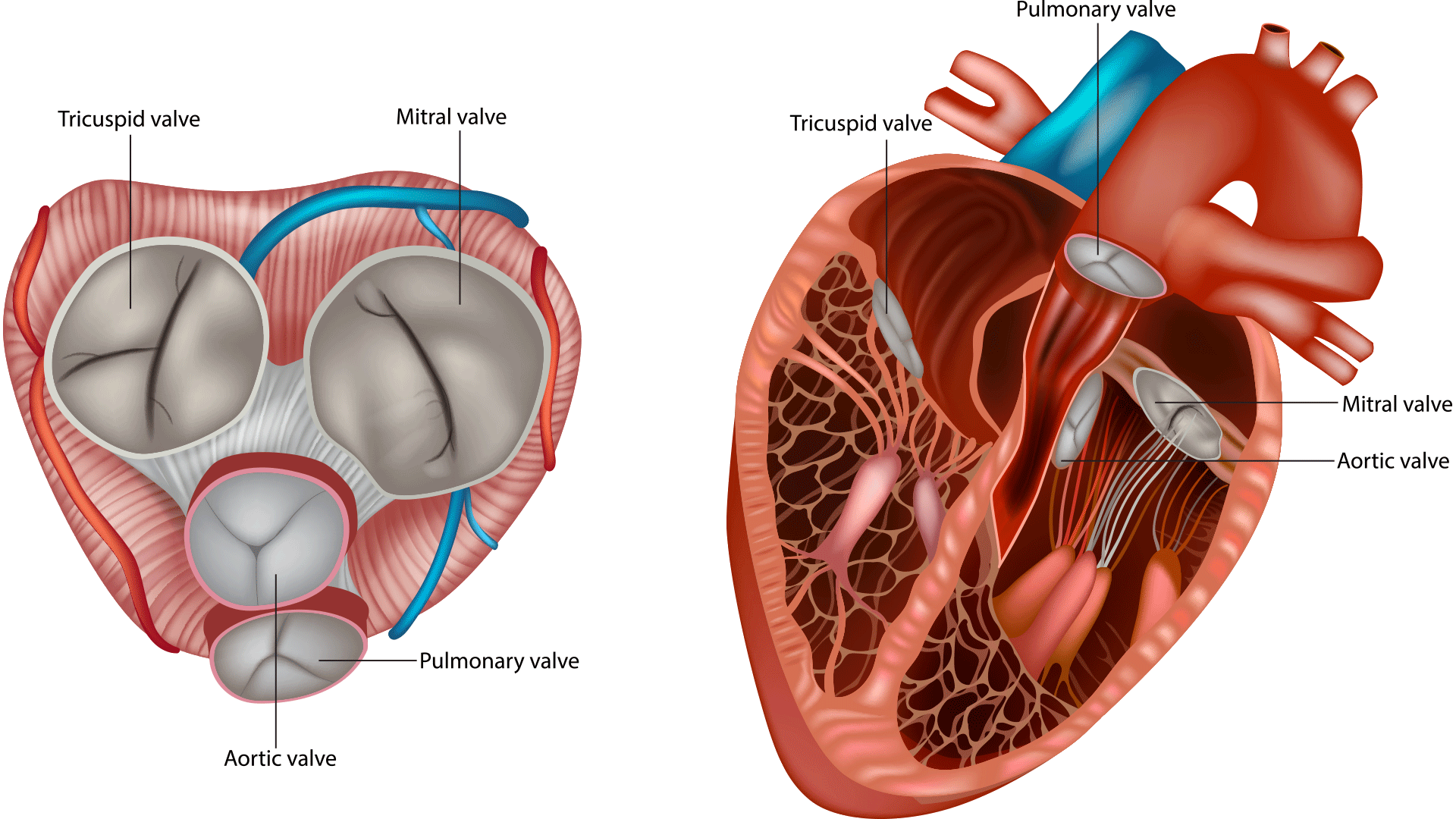 heart valve types graphic