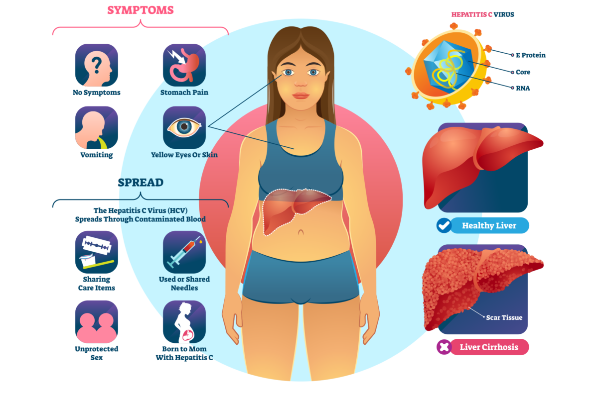 Hepatitis Signature Health Services Hepatitis signature health services