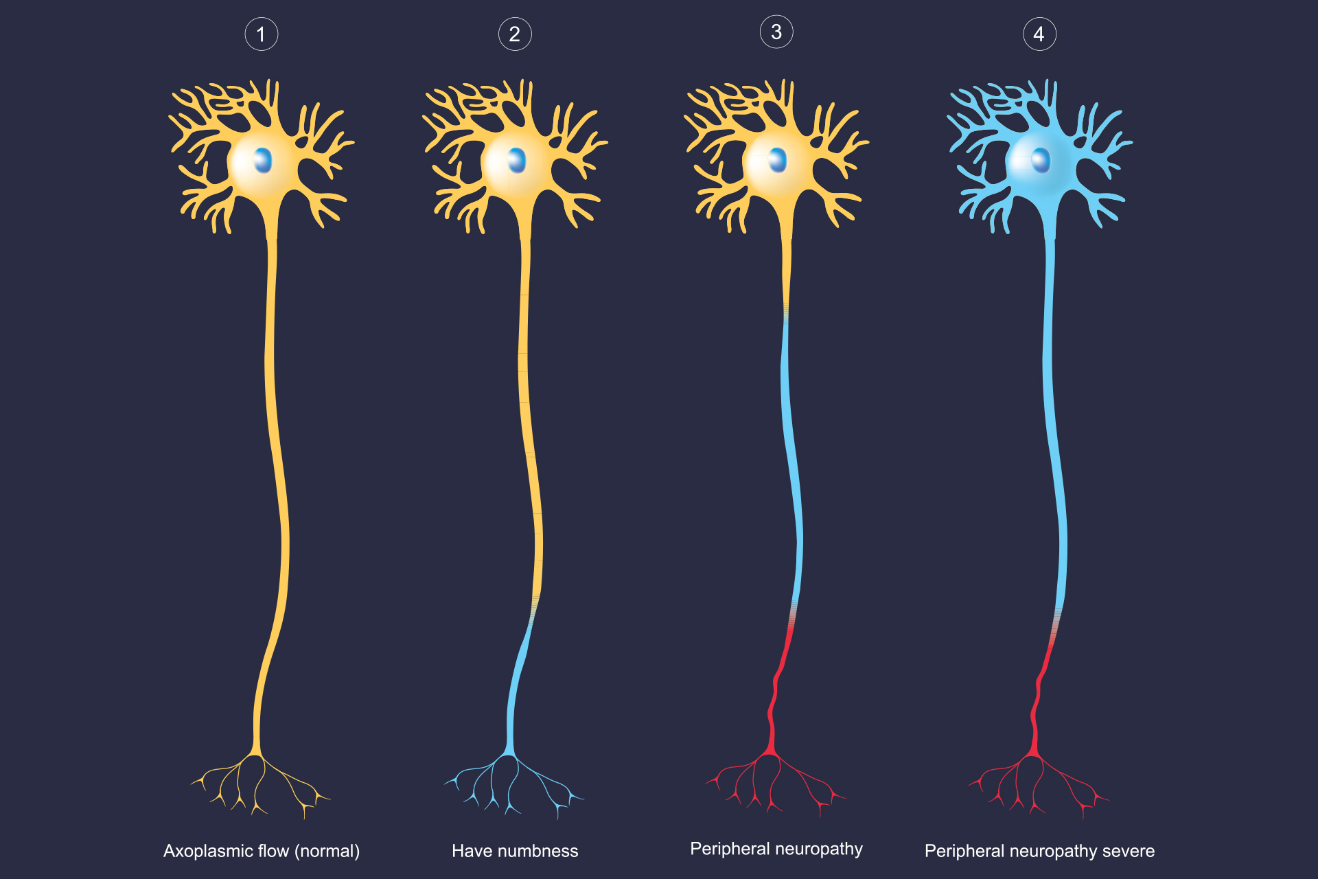 peripheral nerve damage graphic