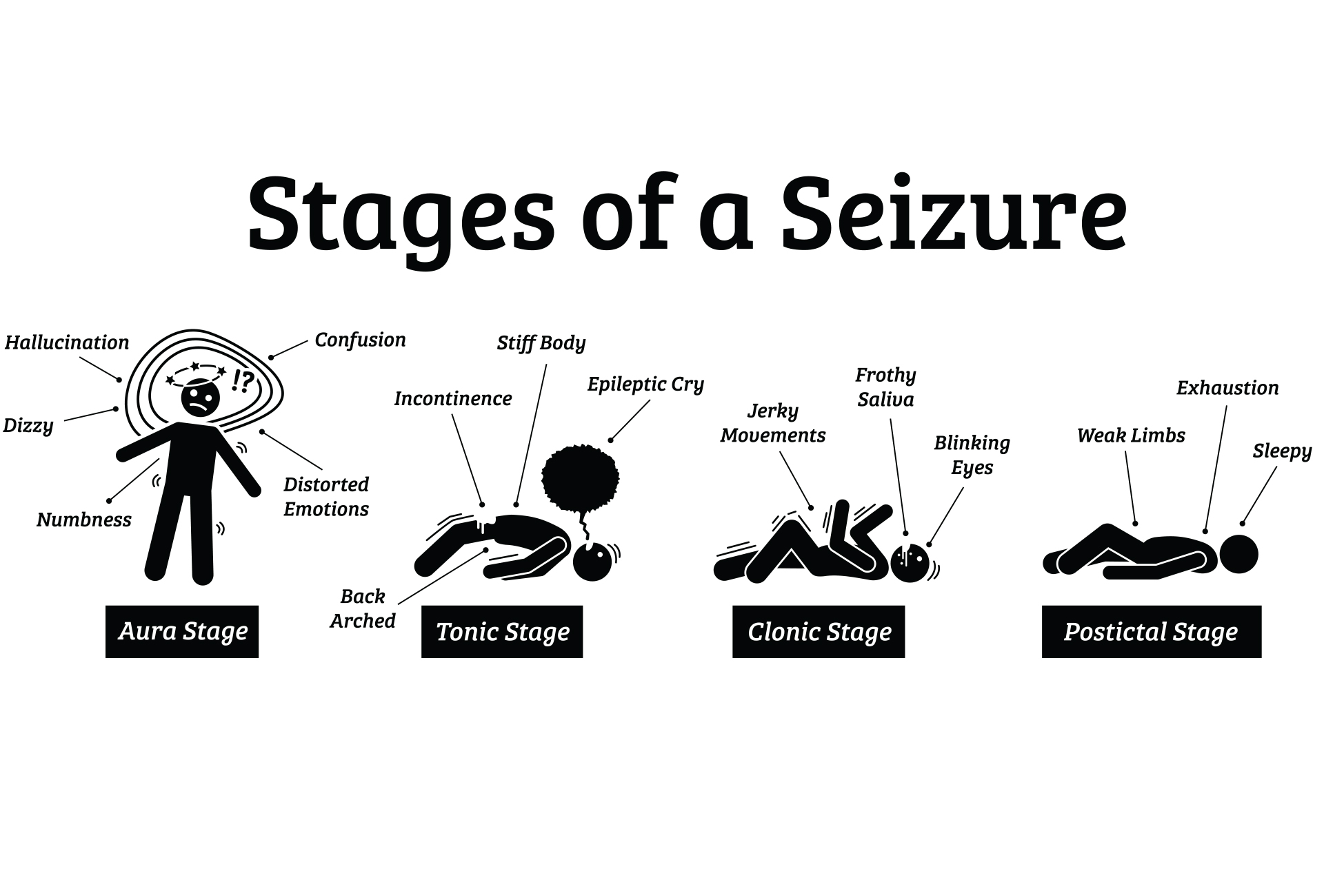 Stages of a seizure graphic