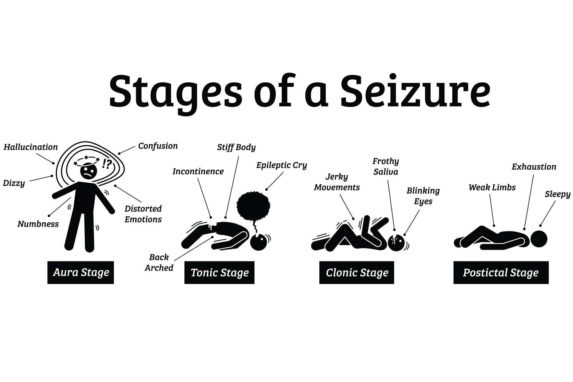 stages of a seizure